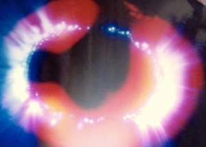 Foto Kirlian SER con campos magneticos